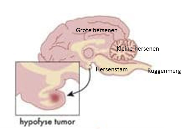 Ziekte Van Cushing En Werken